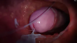 China Twink XXX Tube 1